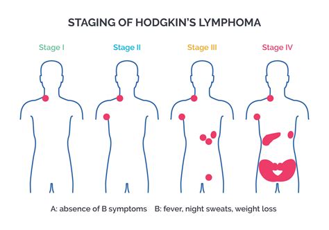 Lymphomas | Hematology and oncology | Pathology | Achievable USMLE/1