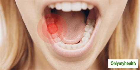 Toothache Relief At Home: 5 Easy Homeopathic Tips And Remedies ...