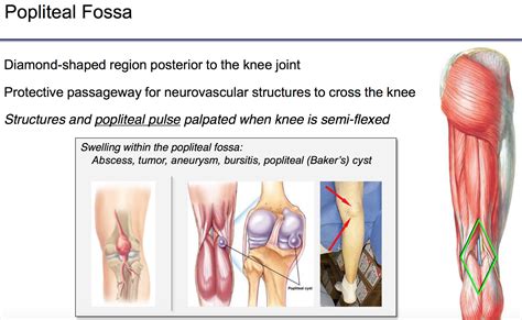 Popliteal Fossa Swelling
