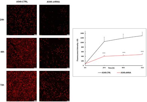 Role of Periostin Expression in Non-Small Cell Lung Cancer: Periostin ...