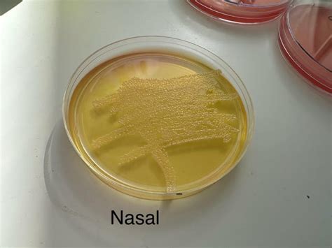 Image result for Enterococcus Faecalis MSA Plate