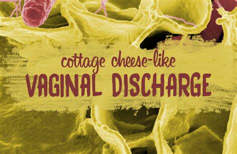 Cottage Cheese Like Discharge Belly Button at Tia Thomas blog