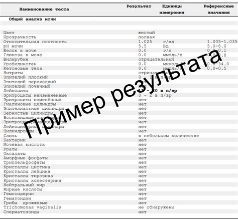 Общий анализ мочи – норма у взрослого и ребенка, расшифровка ...