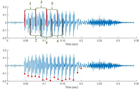 Parkinson’s Disease Classification Framework Using Vocal Dynamics in ...