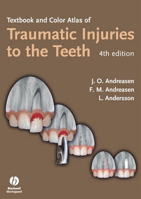 Buy Textbook and Color Atlas of Traumatic Injuries to the Teeth Book ...