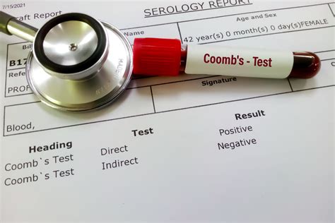 Image result for Coombs Test Positive vs Negative