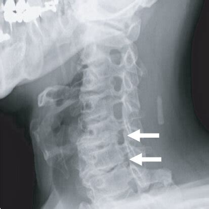 Image result for Contralateral View