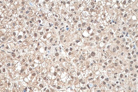 GAPDH antibody (60004-1-PBS) | Proteintech