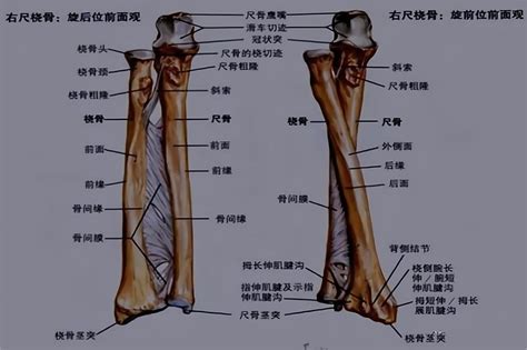 Image result for Difference in Difference Approach Example Diagram