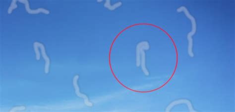 Image result for Eye Floater Types