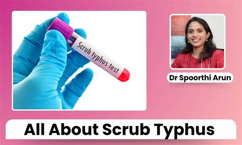 Scrub Typhus: Uncovering the Hidden Dangers and How to Protect Yourself ...