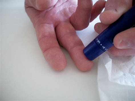 Scientists in India develop biosensor to detect diabetes-related ...