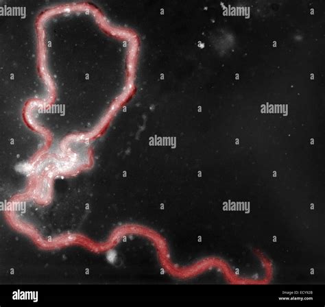 Treponema Pallidum Dark Field