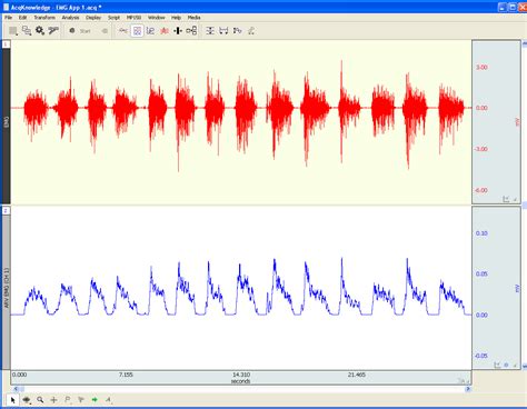 Image result for EMG Tutorials