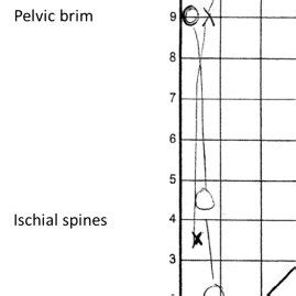 Image result for Partogram Examples