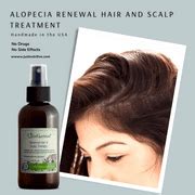 Buy Alopecia Renewal Hair & Scalp Therapy / Alopecia Hair Loss ...