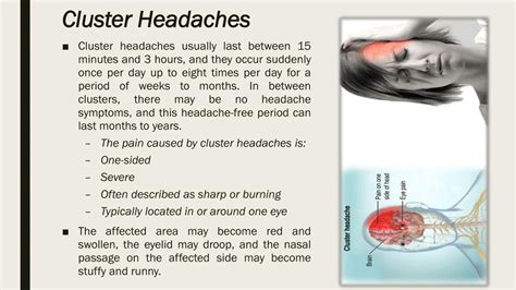 Cluster Headaches Causes at Loren Griffith blog