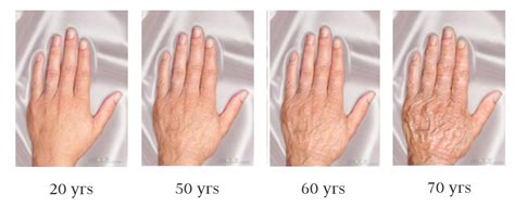 Aging Hand Model 的图像结果