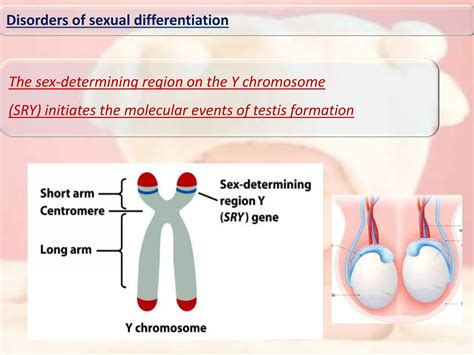 Disorders of sexual differentiation | PPTX