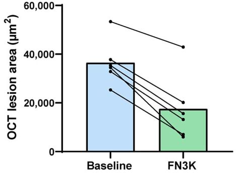 Fructosamine-3-Kinase as a Potential Treatment Option for Age-Related ...