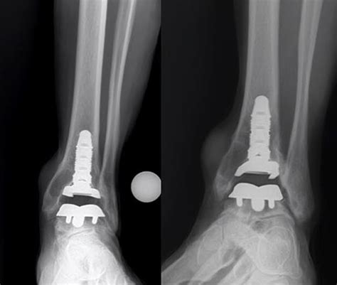 Hardware Monitor Driver 的图像结果