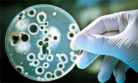 ZR真菌染色液厂家揭示微生物对人类社会有哪些影响？_真菌染色液-快速检测真菌感染及通过荧光显微镜观察真菌荧光染色液品牌/原理/厂家-中仁医学