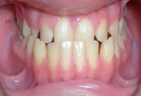 Smile Arc Treatments available in smile arc dental vijayawada