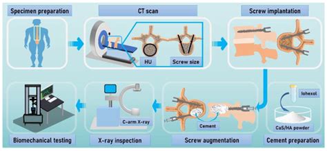 Evaluation of an Injectable Biphasic Calcium Sulfate/Hydroxyapatite ...