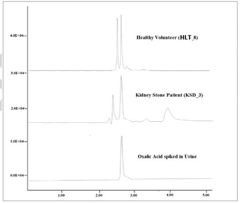 Fig. 1: Chromatograms of oxalic acid in various urine samples