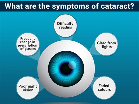 What Are The Warning Signs Of Cataracts at Max Monte blog