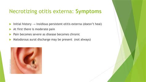 Necrotizing Otitis Externa
