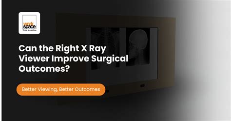 X Ray Viewer Manufacturer | OT Equipment | WMSPL