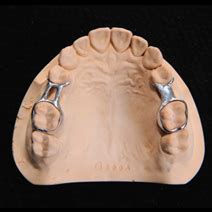 SM Dental Labs