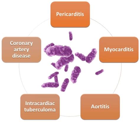 Cardiovascular Involvement in Tuberculosis: From Pathophysiology to ...