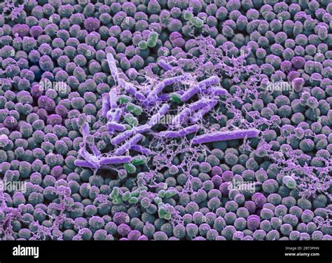 Bacteria on human skin sem hi-res stock photography and images - Alamy