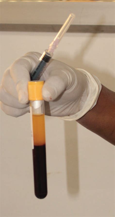 PRF Protocol 的图像结果