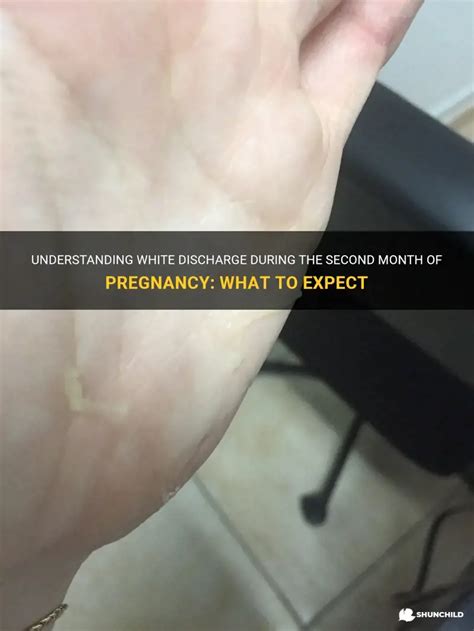 Understanding White Discharge During The Second Month Of Pregnancy ...