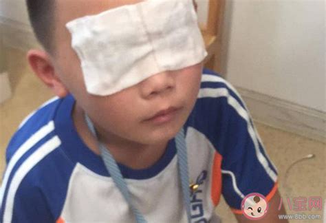 杭州一幼儿园27个孩子眼睛遭紫外线灯灼伤，将组织集体会诊_长三角政商_澎湃新闻-The Paper