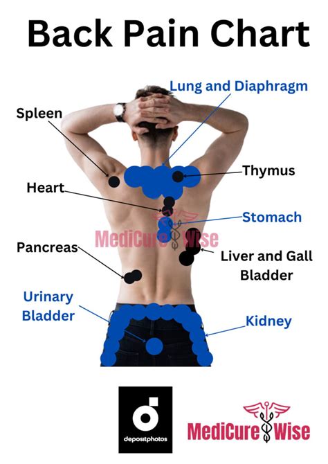 Image result for Lower Back Pain Chart