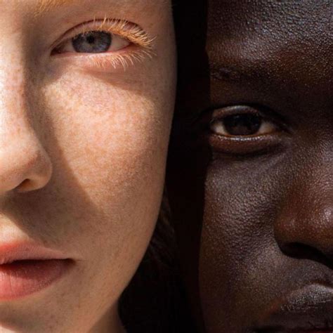 Skin Types 的图像结果