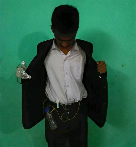 17 year old Despite his childhood disability achieves a milestone as a ...