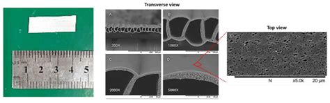 Microtube Array Membrane (MTAM)-Based Encapsulated Cell Therapy for ...