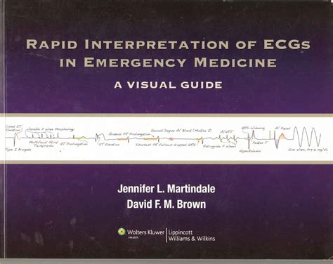 Rapid Interpretation of ECGs in Emergency Medicine: A Visual Guide ...