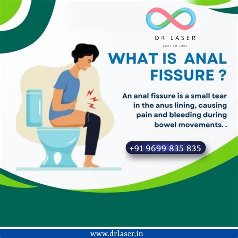 Understanding Anal Fissures | DrLaser Clinic Mumbai | Proctologist | General Surgeon ...
