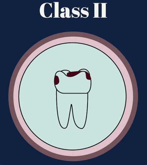 Image result for Tooth Numbering System