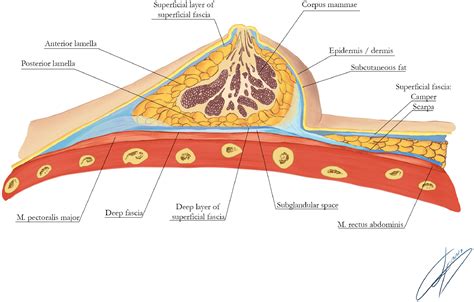 The Different Surgical Strategies for Treating Tuberous Breast Deformity: A Scoping Review ...