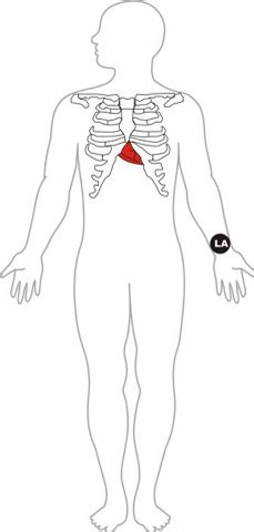 ECG Colour Codes Explained | Biometric Cables