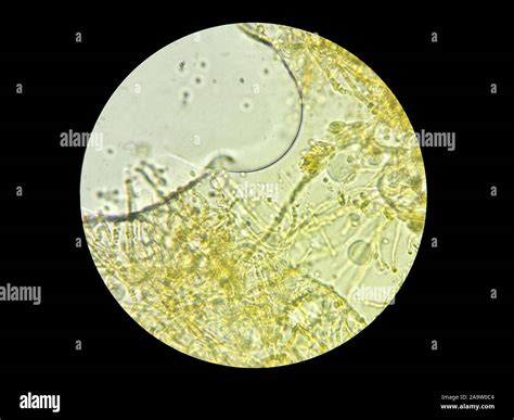 Microscope Bacteria 的图像结果