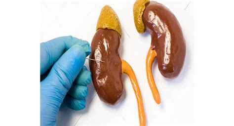Normal Histology of Kidney | SAKSHAM LMIS - NIHFW