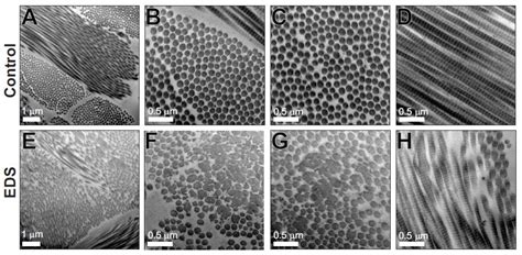 Identification of Two Independent COL5A1 Variants in Dogs with Ehlers ...